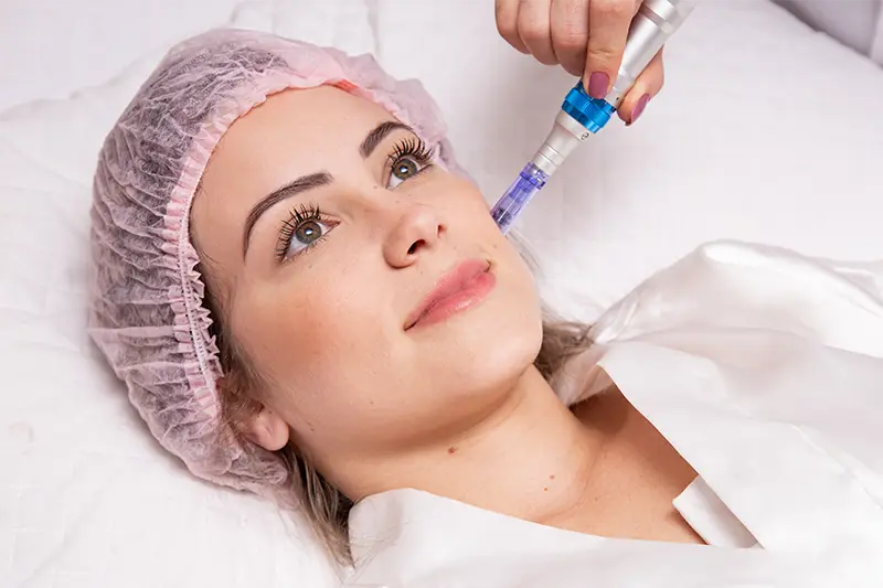 MMP® Facial — Microinfusão de Medicamentos na Pele