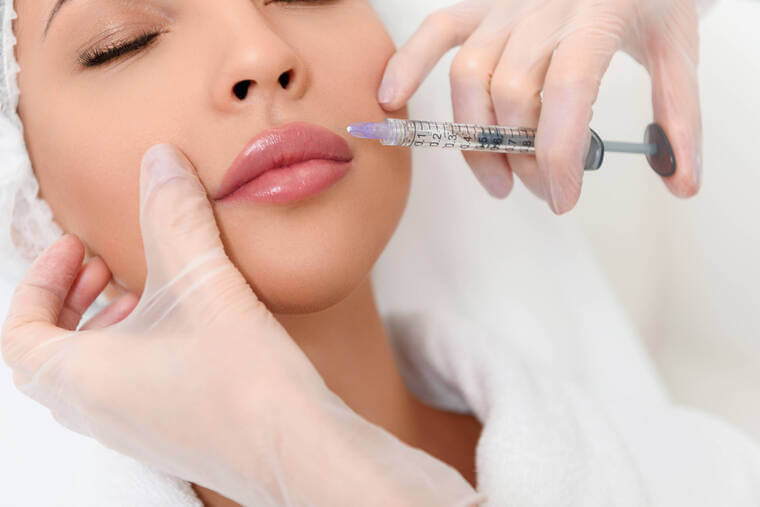 Preenchimento Labial